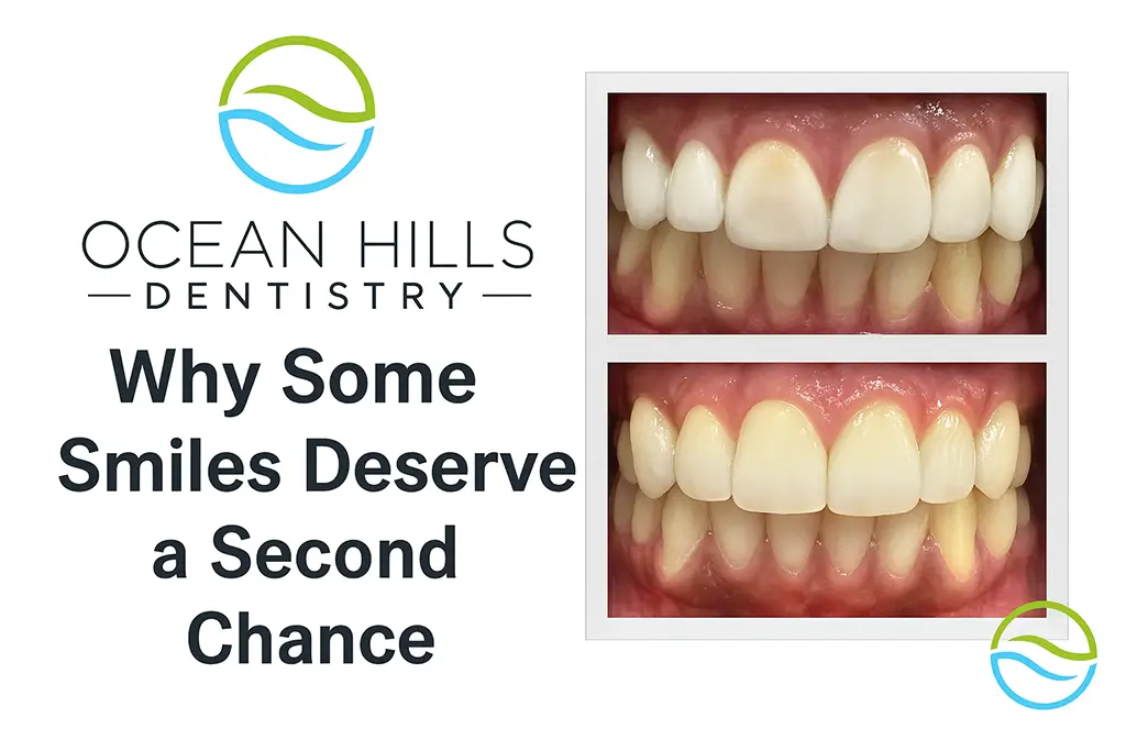 Insights Before and After Image of Smile Revision by Ocean Hills Dentistry