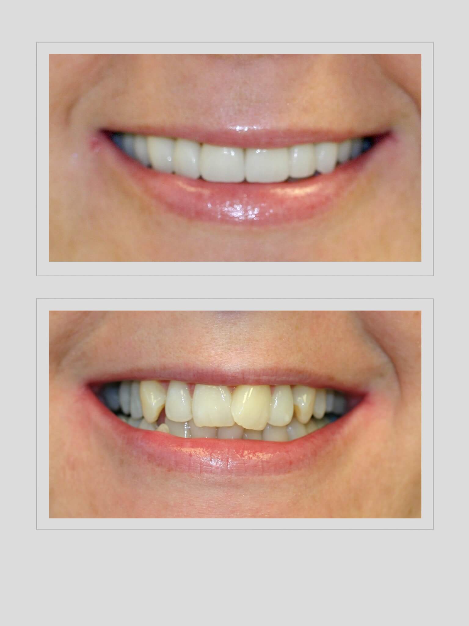 Ocean Hills Dentistry - Creating Beautiful Smiles