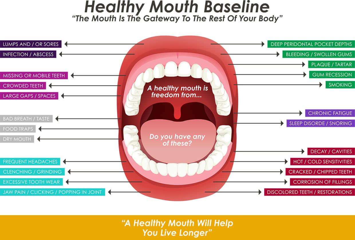 Healthy Mouth Baseline