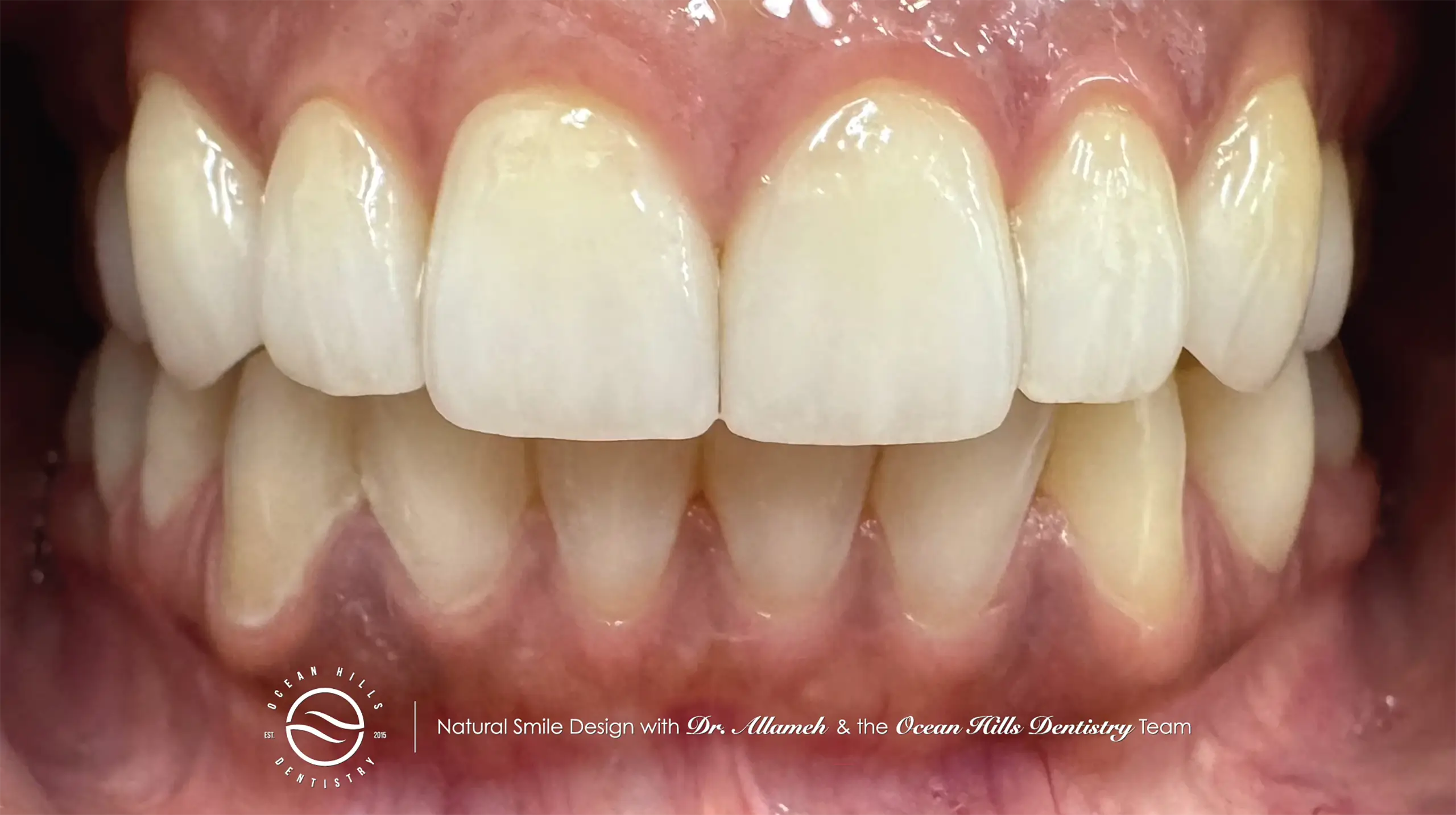 Ocean Hills Dentistry Smile Gallery Banner